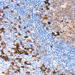 CD38 Antibody in Immunohistochemistry (Paraffin) (IHC (P))