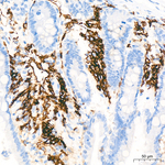 CD38 Antibody in Immunohistochemistry (Paraffin) (IHC (P))