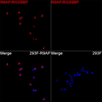 R9BP Recombinant Rabbit Monoclonal Antibody (10U1U1)