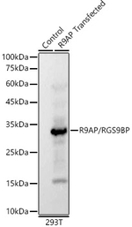 R9BP Antibody in Western Blot (WB)