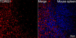 TCIRG1 Antibody in Immunohistochemistry (Paraffin) (IHC (P))