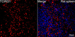 TCIRG1 Antibody in Immunohistochemistry (Paraffin) (IHC (P))