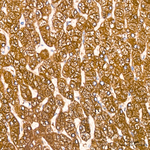 TCIRG1 Antibody in Immunohistochemistry (Paraffin) (IHC (P))