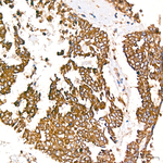 TCIRG1 Antibody in Immunohistochemistry (Paraffin) (IHC (P))