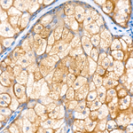 TCIRG1 Antibody in Immunohistochemistry (Paraffin) (IHC (P))