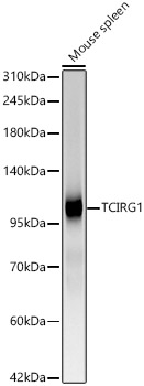 TCIRG1 Antibody in Western Blot (WB)