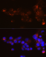 LDLR Recombinant Rabbit Monoclonal Antibody (1M9P3)