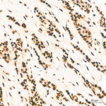 FTO Recombinant Rabbit Monoclonal Antibody (9K4T3)