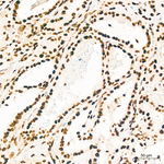 FTO Antibody in Immunohistochemistry (Paraffin) (IHC (P))