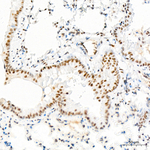 FTO Antibody in Immunohistochemistry (Paraffin) (IHC (P))