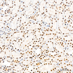 FTO Antibody in Immunohistochemistry (Paraffin) (IHC (P))
