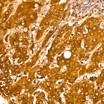 PMPCA Antibody in Immunohistochemistry (Paraffin) (IHC (P))