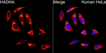 HADHA Recombinant Rabbit Monoclonal Antibody (5F7W6)