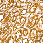 HADHA Antibody in Immunohistochemistry (Paraffin) (IHC (P))