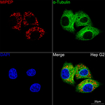 MIPEP Recombinant Rabbit Monoclonal Antibody (9W4P1)