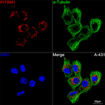 PITRM1 Recombinant Rabbit Monoclonal Antibody (3M3J3)