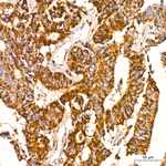 PITRM1 Antibody in Immunohistochemistry (Paraffin) (IHC (P))
