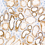 PITRM1 Antibody in Immunohistochemistry (Paraffin) (IHC (P))