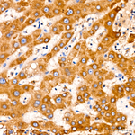 PITRM1 Antibody in Immunohistochemistry (Paraffin) (IHC (P))