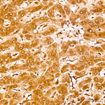 PABPC1 Antibody in Immunohistochemistry (Paraffin) (IHC (P))