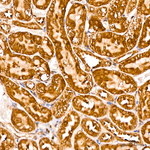 PABPC1 Antibody in Immunohistochemistry (Paraffin) (IHC (P))