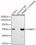 PABPC1 Antibody in Immunoprecipitation (IP)