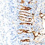 HNF4G Antibody in Immunohistochemistry (Paraffin) (IHC (P))