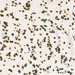 H3K27me3 Antibody in Immunohistochemistry (Paraffin) (IHC (P))
