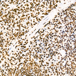 H3K27me3 Antibody in Immunohistochemistry (Paraffin) (IHC (P))