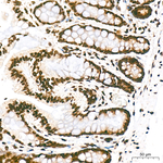 H3K27me3 Antibody in Immunohistochemistry (Paraffin) (IHC (P))