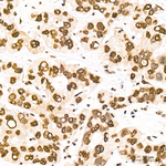 H3K27me3 Antibody in Immunohistochemistry (Paraffin) (IHC (P))