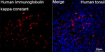 Kappa Light Chain Antibody in Immunohistochemistry (Paraffin) (IHC (P))