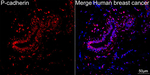 P-cadherin Antibody in Immunohistochemistry (Paraffin) (IHC (P))