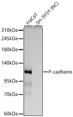 P-cadherin Antibody in Western Blot (WB)