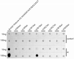 H3K18ac Antibody in Dot Blot (DB)