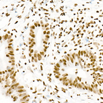 H3K18ac Antibody in Immunohistochemistry (Paraffin) (IHC (P))