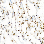 H3K18ac Antibody in Immunohistochemistry (Paraffin) (IHC (P))