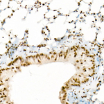 H3K18ac Antibody in Immunohistochemistry (Paraffin) (IHC (P))
