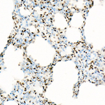 H3K18ac Antibody in Immunohistochemistry (Paraffin) (IHC (P))