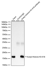 H3K18ac Antibody in Immunoprecipitation (IP)