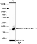 H3K18ac Antibody in Western Blot (WB)