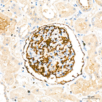 CD35 Antibody in Immunohistochemistry (Paraffin) (IHC (P))