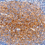 CD35 Antibody in Immunohistochemistry (Paraffin) (IHC (P))