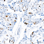H4K20me1 Recombinant Rabbit Monoclonal Antibody (8H1K6)