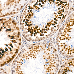 H4K20me1 Antibody in Immunohistochemistry (Paraffin) (IHC (P))