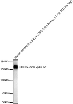 HCoV-229E Spike S2 Recombinant Rabbit Monoclonal Antibody (6P2H6)