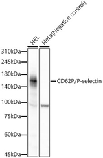 P-Selectin Antibody in Western Blot (WB)