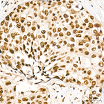 KPNA6 Antibody in Immunohistochemistry (Paraffin) (IHC (P))