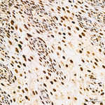 KPNA6 Antibody in Immunohistochemistry (Paraffin) (IHC (P))