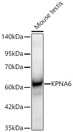 KPNA6 Antibody in Western Blot (WB)